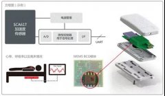 医疗传感器助力医学发展，未来可穿戴设备市场